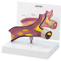 Artery Budget Model