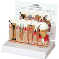Teeth Budget Model