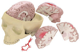Brain and Partial Skull Budget Model