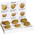 Prostate-set of 6 Budget Model