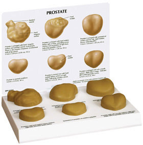 Prostate-set of 6 Budget Model