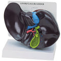 Liver Budget Model