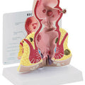 Rectum Budget Model