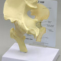 Basic Hip - Budget Model