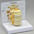 Basic Vertebrae - Budget Model