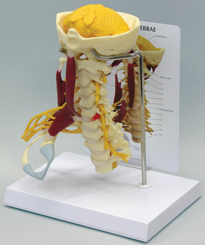 Muscled Cervical - Budget Model