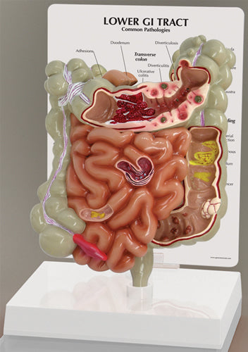 GI Tract - Budget Model