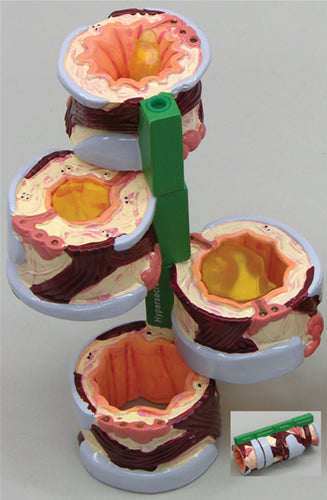 4-Piece Bronchus - Budget Model