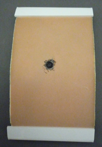 Skin Pad, Melanoma