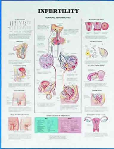 Infertility Chart