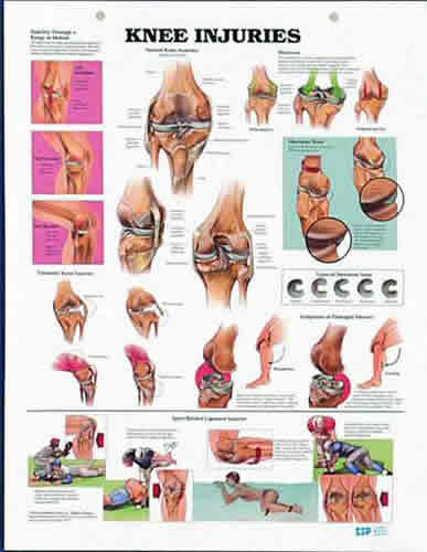 Knee Injuries Chart