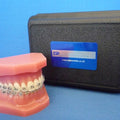 Orthodontic Maxilla & Mandible with Fixed Braces