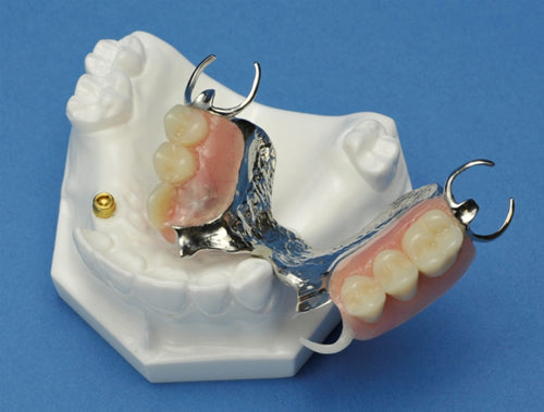 Partial Framework Maxilla with Locator Stud & Cap