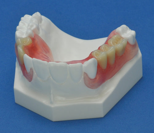 Crown & Bridge Combination Maxilla