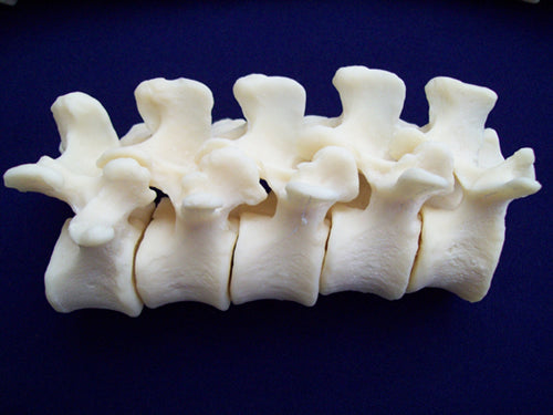 Lumbar - Vertebra