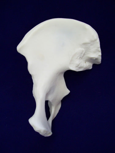 Pelvis Wing (innominate bone)