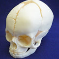 Foetal Skull