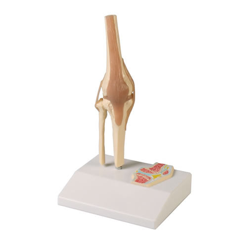 Knee Joint, 1/2 Life Size with Cross Section
