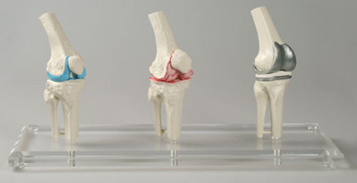 Knee Implant Model, Set of 3 Joints
