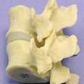 Vertebral Joint