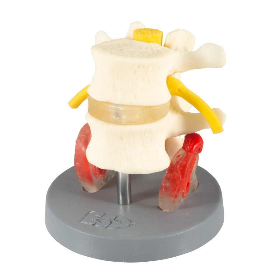 Dissectible Lumbar Vertebrae