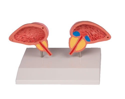 Male Urinary Bladder and Prostate, 2-Part