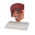 Gallstone Model