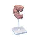 Human Embryo