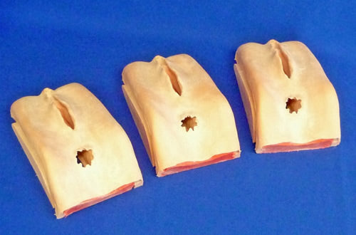 Perineal Repair Replacements