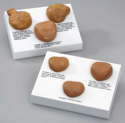 Prostate Set - Budget Model